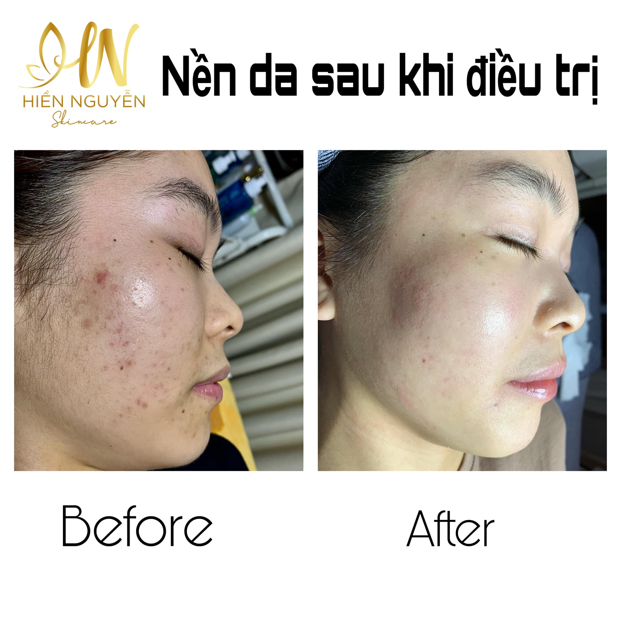 Hiền Nguyễn Skincare ảnh 1