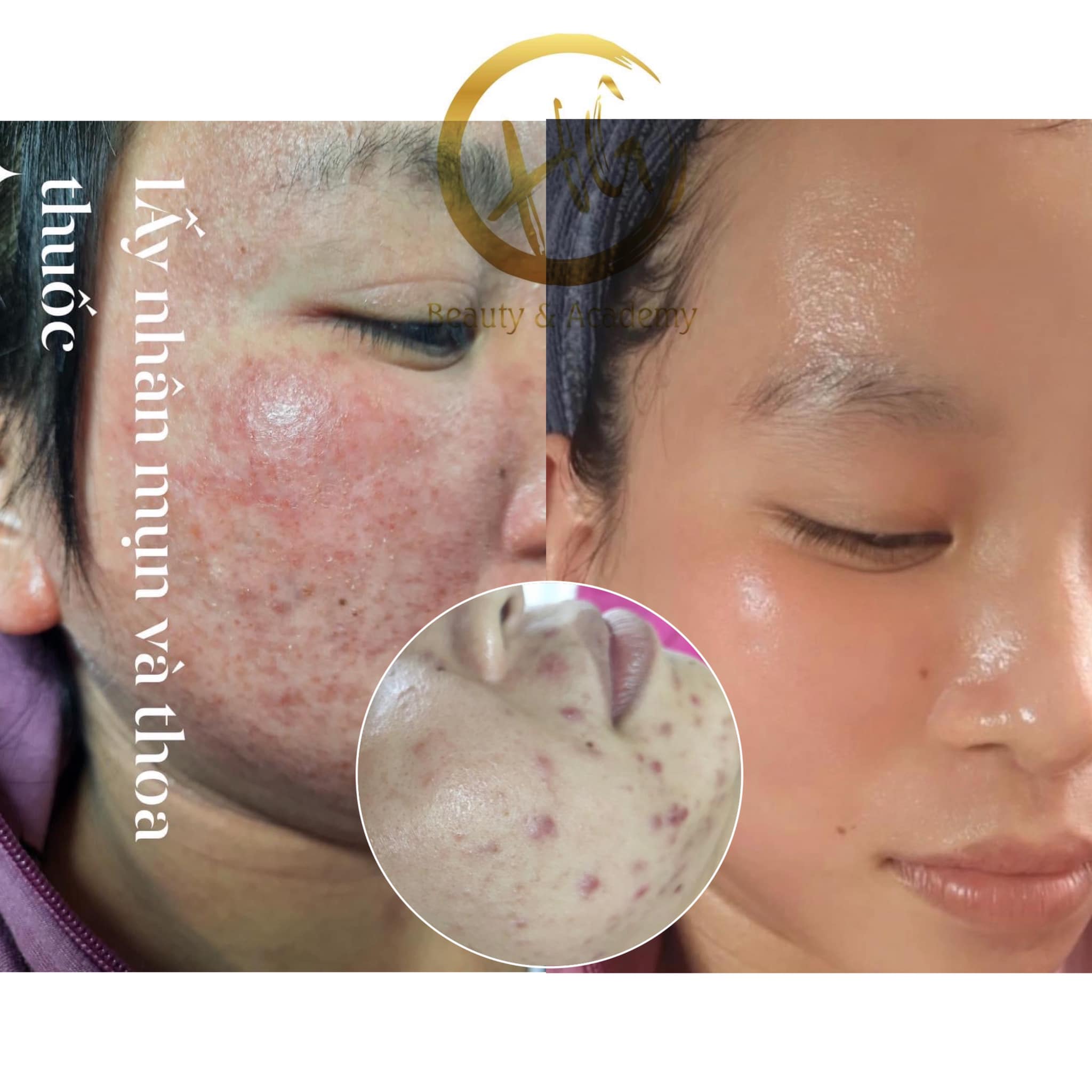 Huỳnh Giao Skincare & Beauty ảnh 2