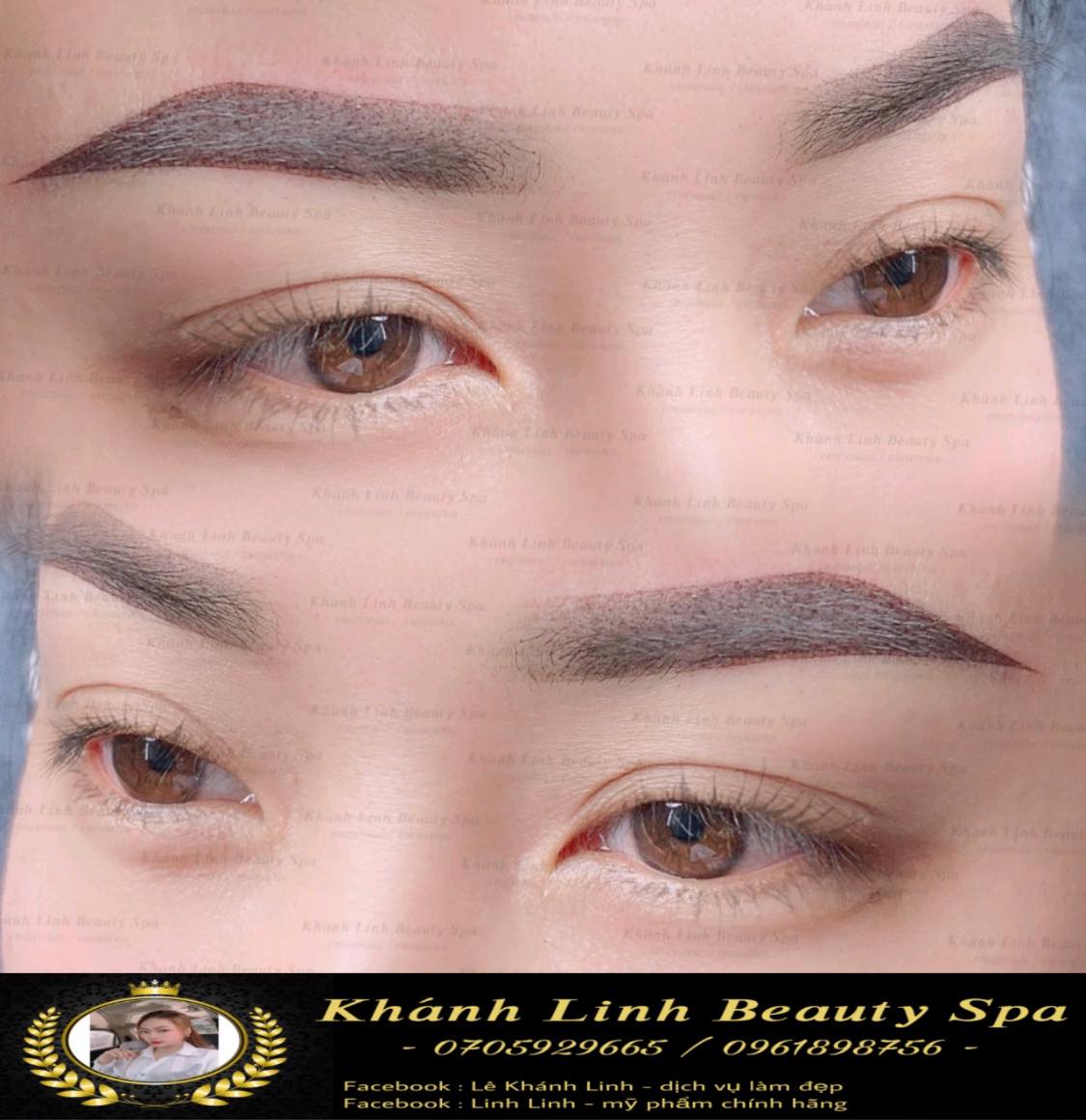 Khánh Linh Beauty Spa ảnh 2