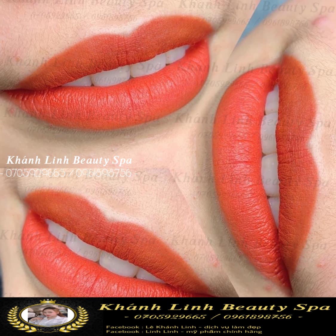 Khánh Linh Beauty Spa ảnh 1