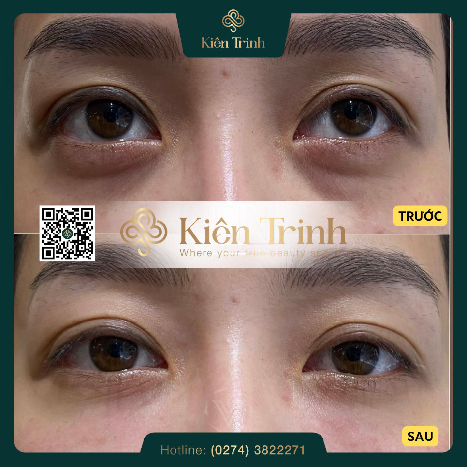 Kiên Trinh Beauty Spa ảnh 2