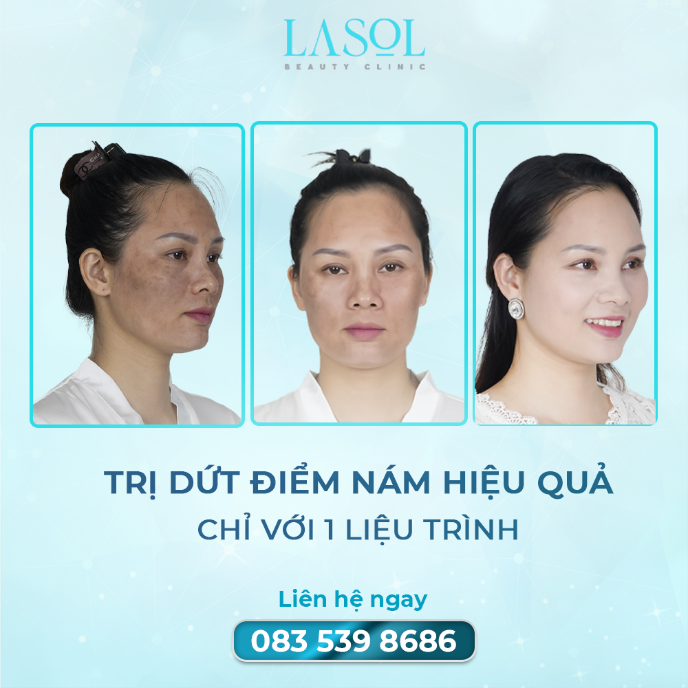 LaSol Beauty ảnh 2