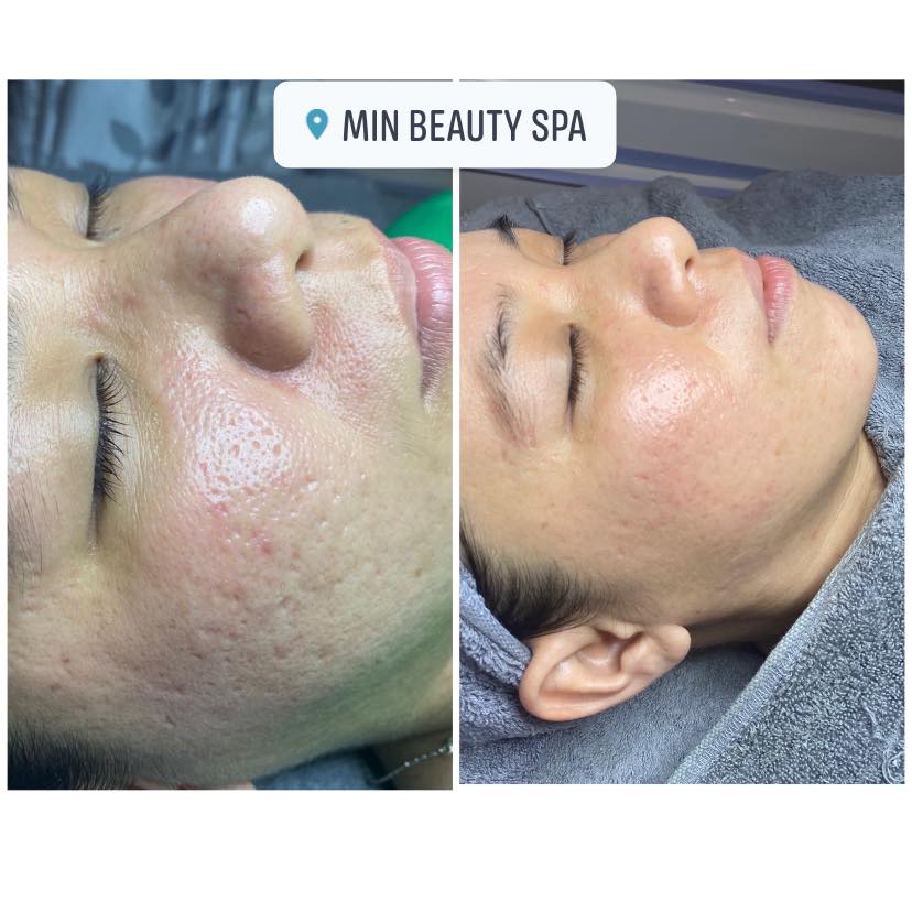 Min Beauty Spa ảnh 2