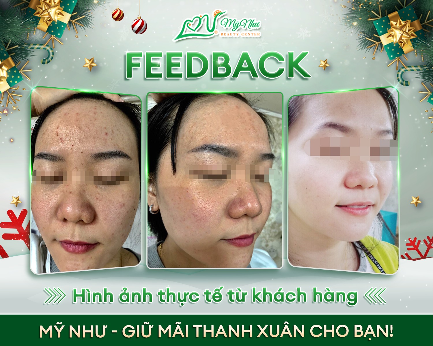 Mỹ Như Beauty Center & Spa ảnh 2