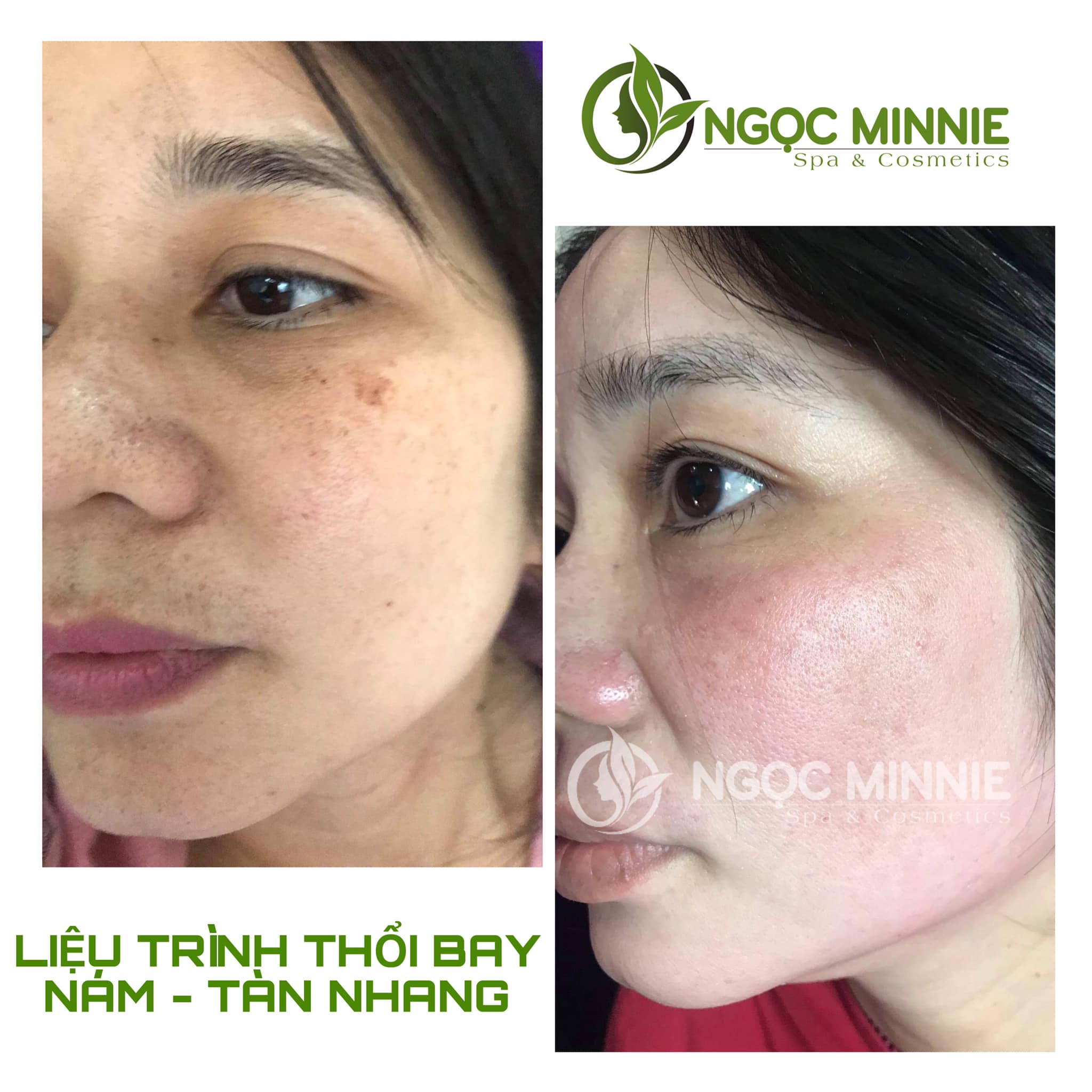 Ngọc Minnie Spa ảnh 2