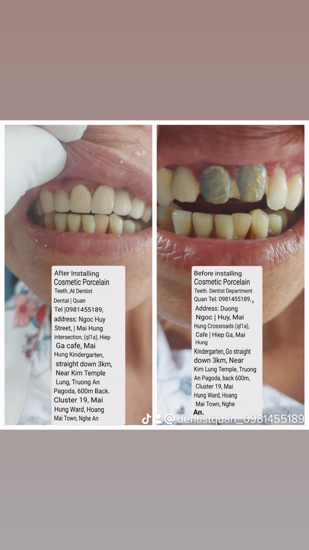 Nha Khoa Dentist Quân ảnh 2