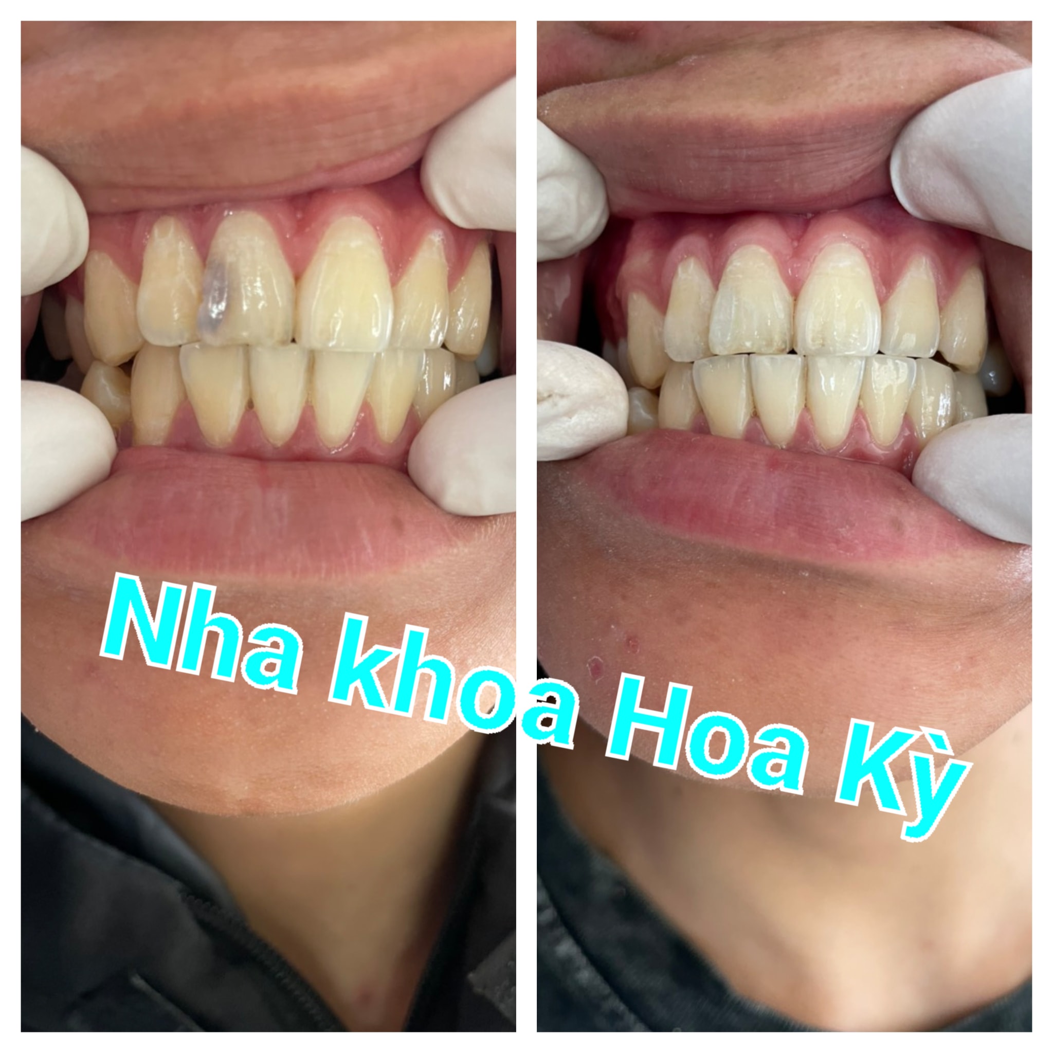 Nha Khoa Hoa Kỳ ảnh 1