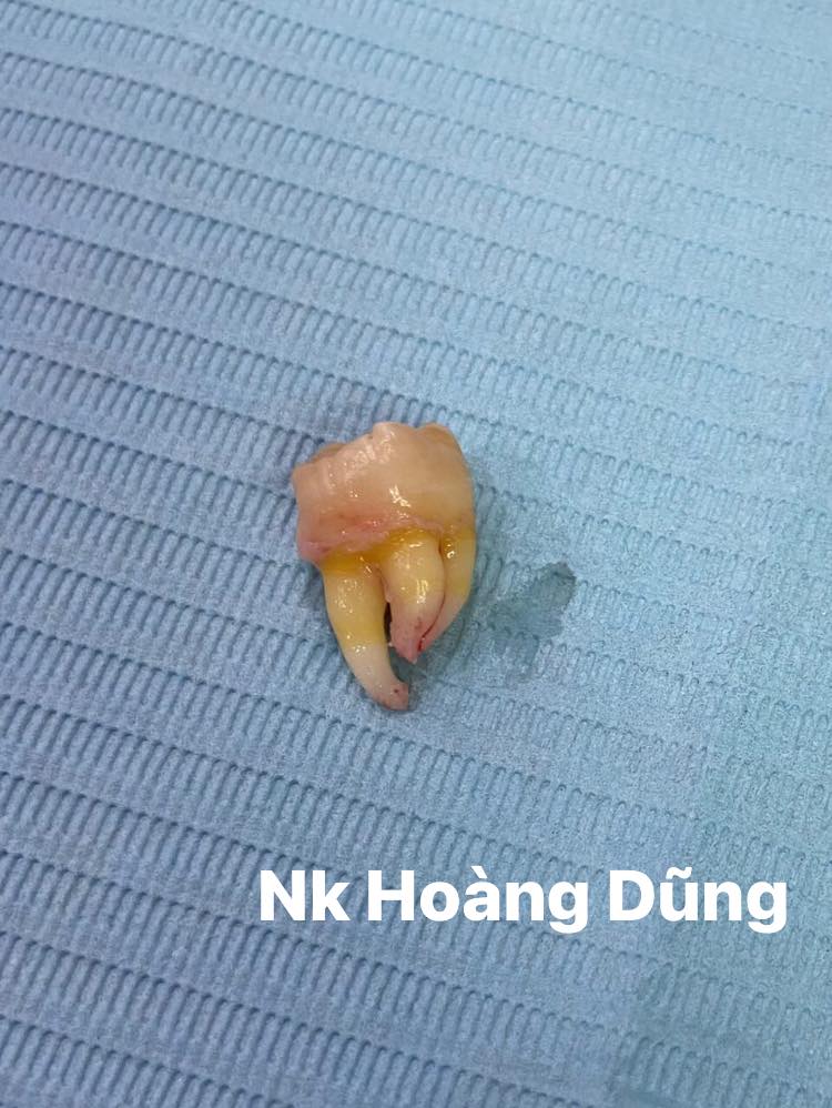 Nha khoa Hoàng Dũng ảnh 2