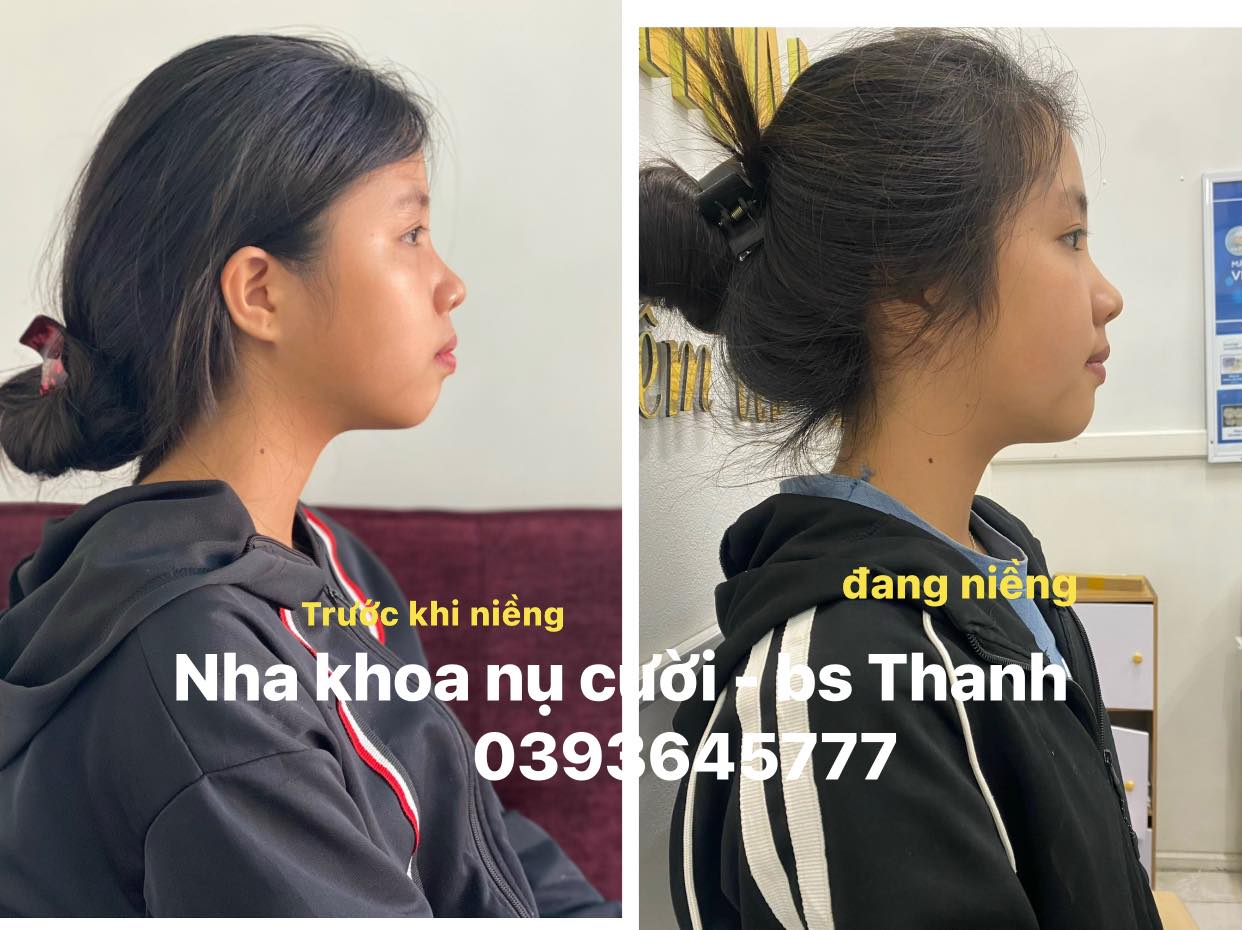 Nha khoa Nụ Cười - Bác sĩ Thanh ảnh 2