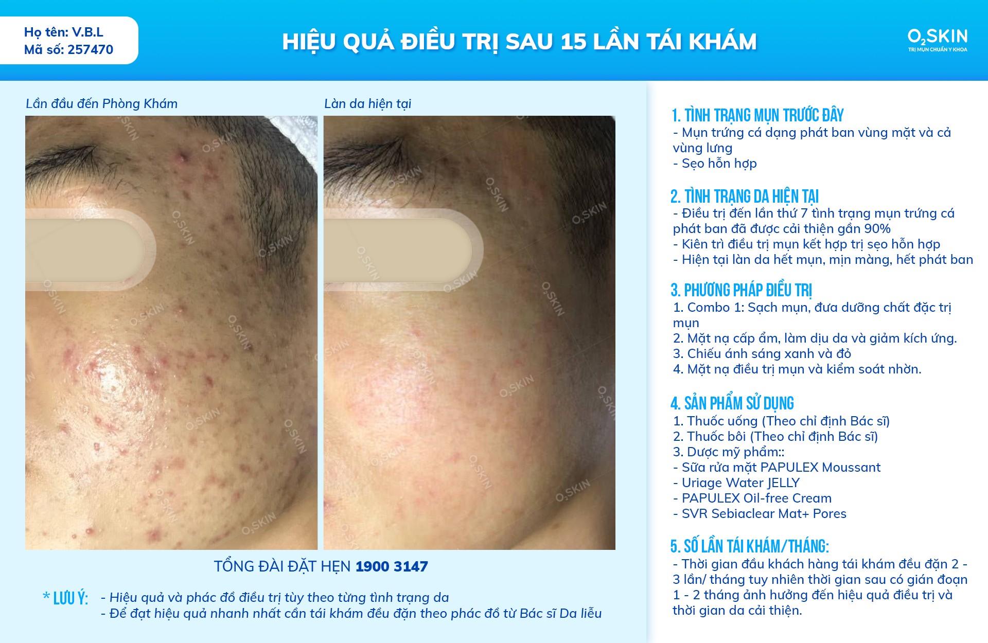 O2 SKIN ảnh 2