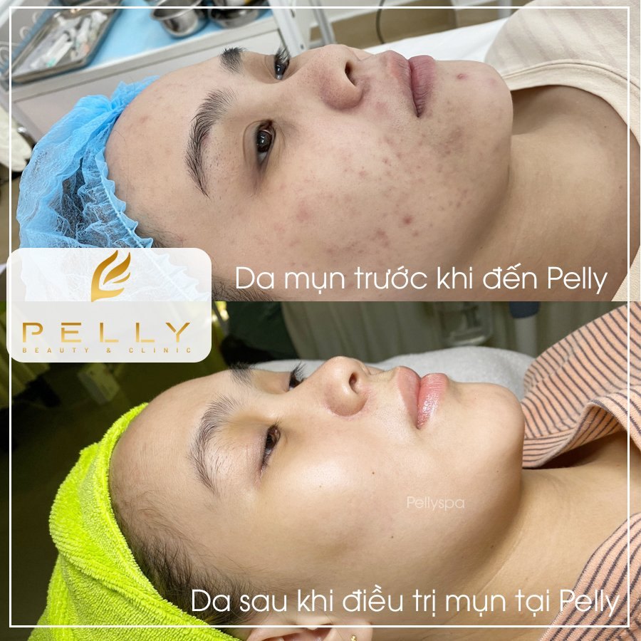 Pelly Spa Trảng Bàng ảnh 2