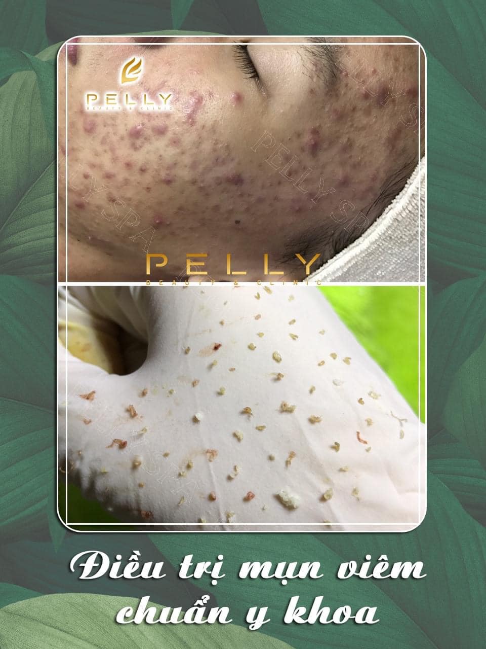 Pelly Spa Trảng Bàng ảnh 1