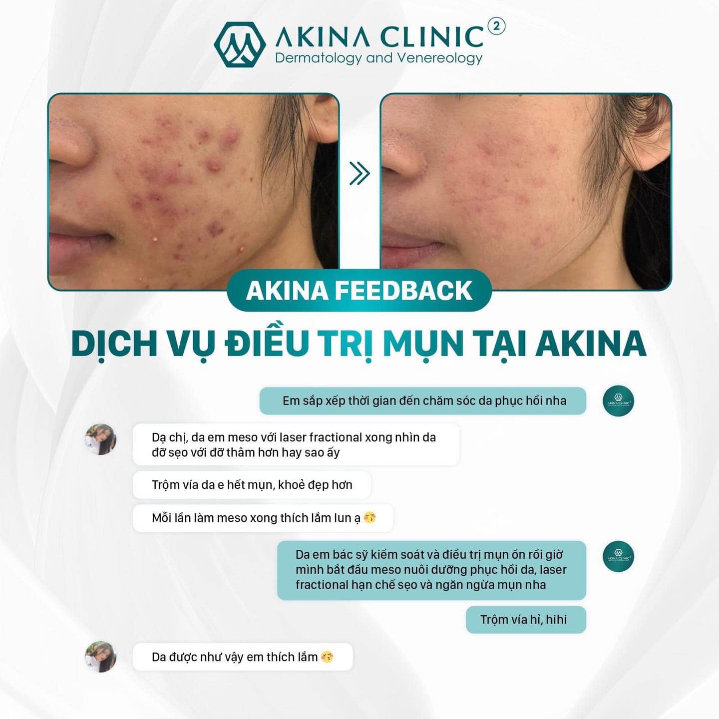 Phòng khám da liễu AKINA Acne ảnh 1