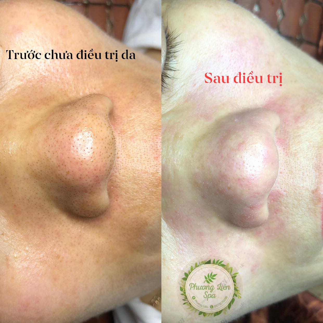 Phương Liên Spa ảnh 2