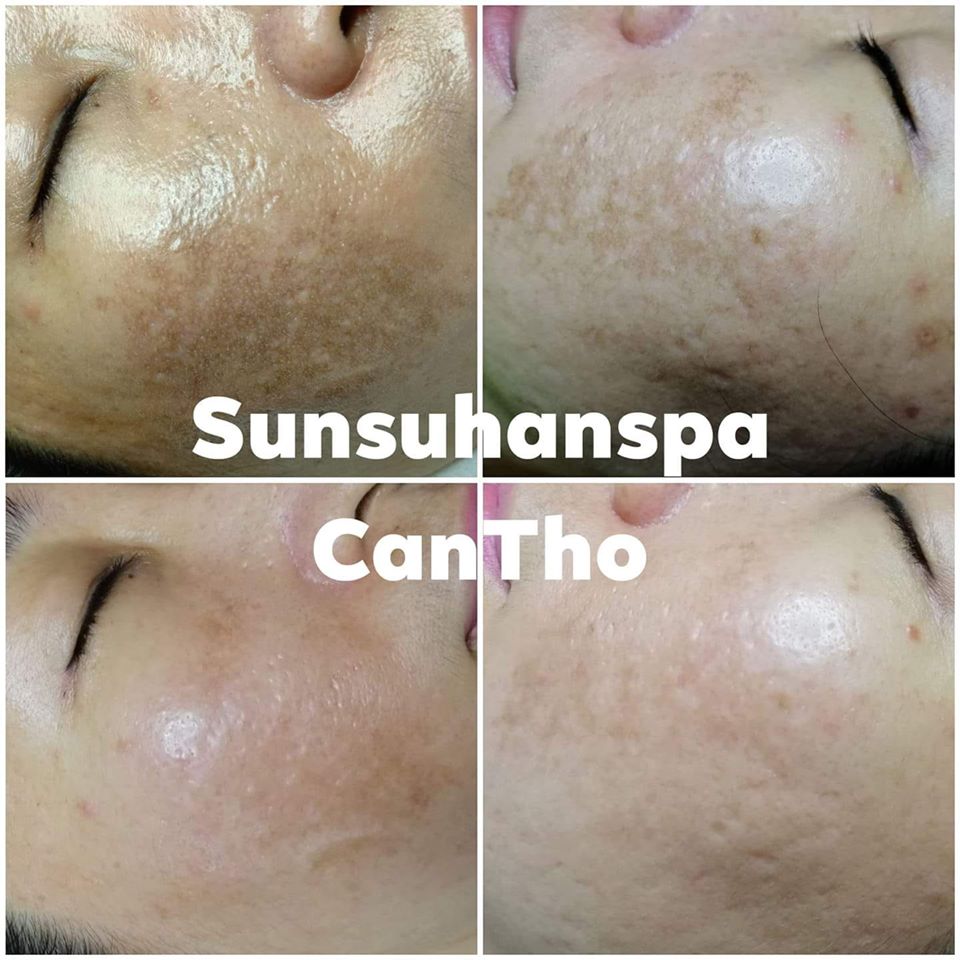 SUNSUHAN Spa Cần Thơ ảnh 2