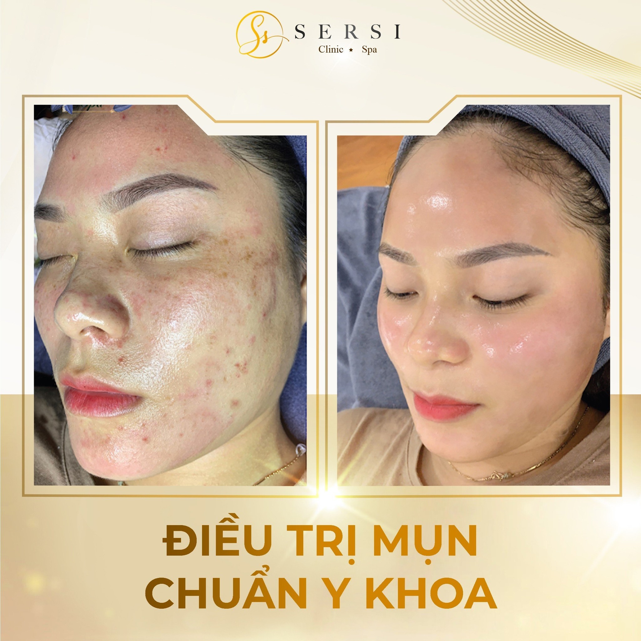 SerSi Clinic & Spa - TP. Bắc Giang ảnh 2