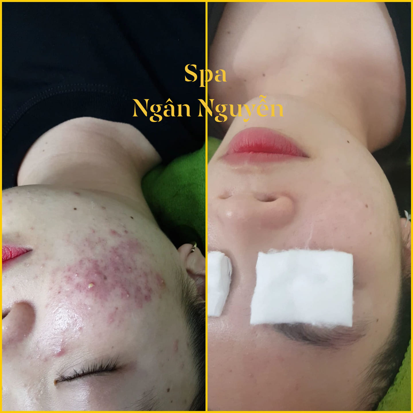 Spa Ngân Nguyễn ảnh 2