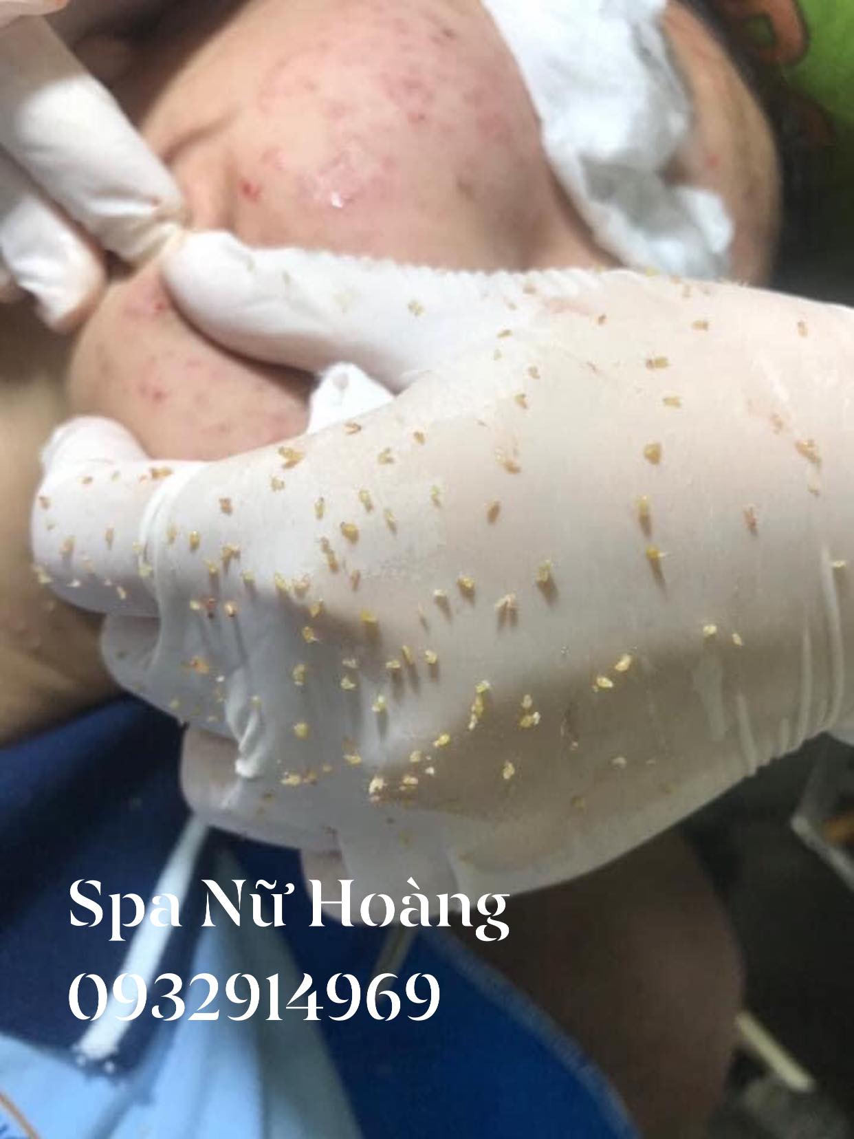 Spa Nữ Hoàng ảnh 1