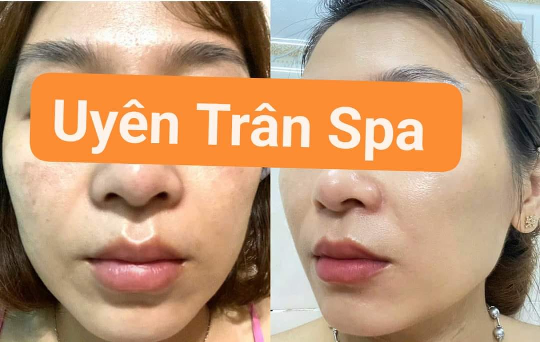 Spa Uyên Trân ảnh 1