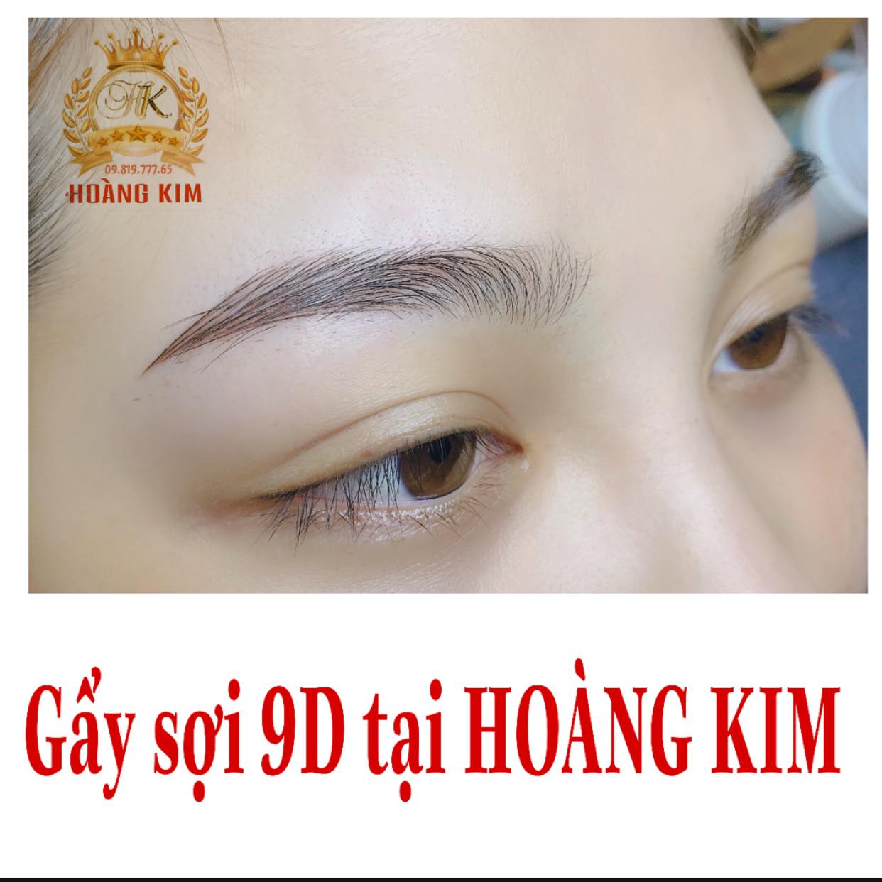 Thẩm Mỹ Hoàng Kim ảnh 2