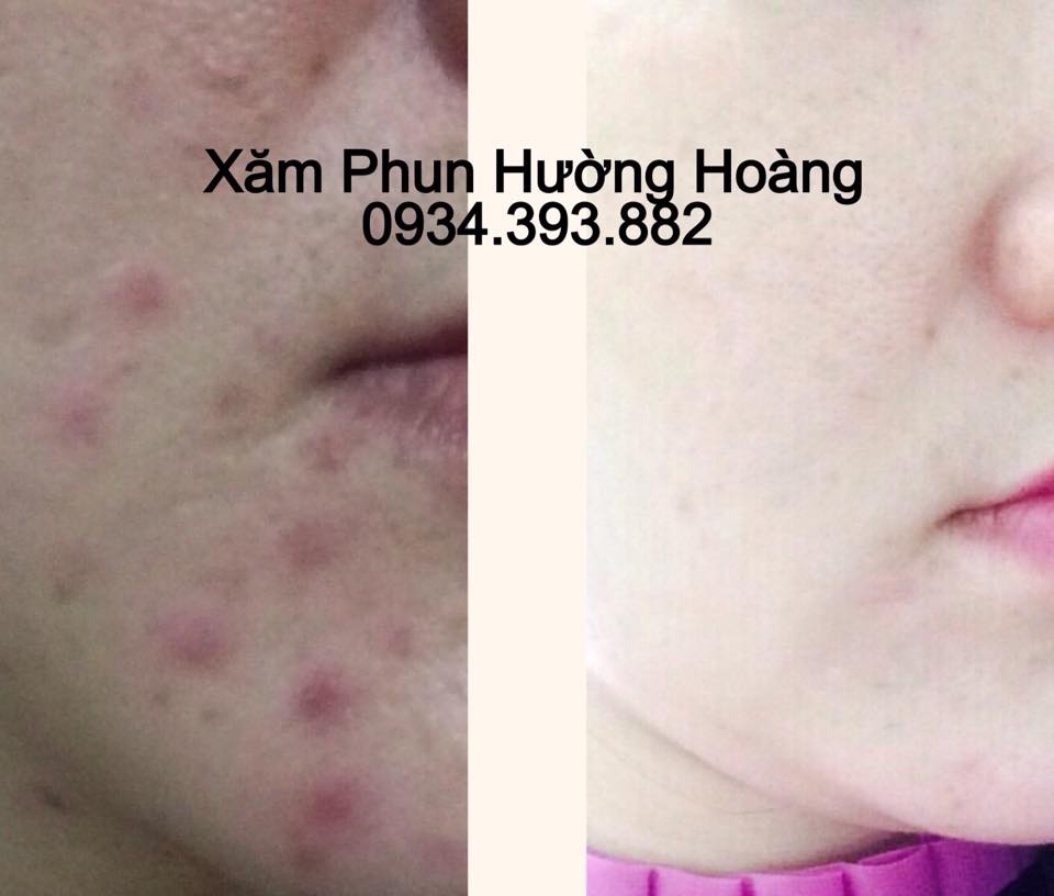 Thẩm Mỹ Hường Hoàng ảnh 2