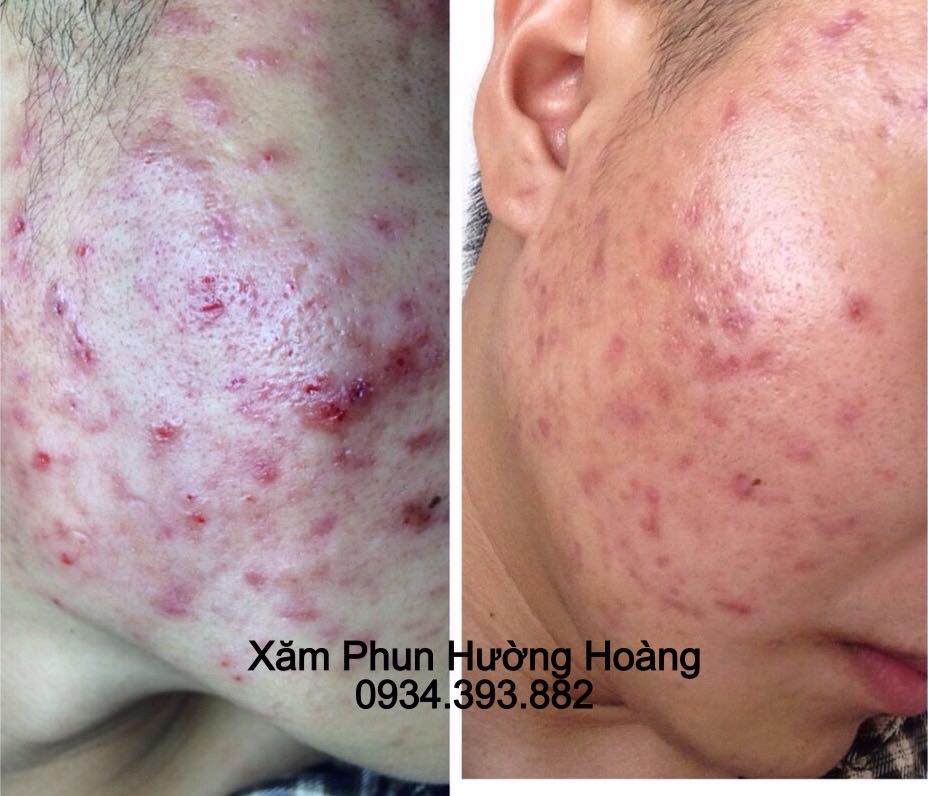 Thẩm Mỹ Hường Hoàng ảnh 1