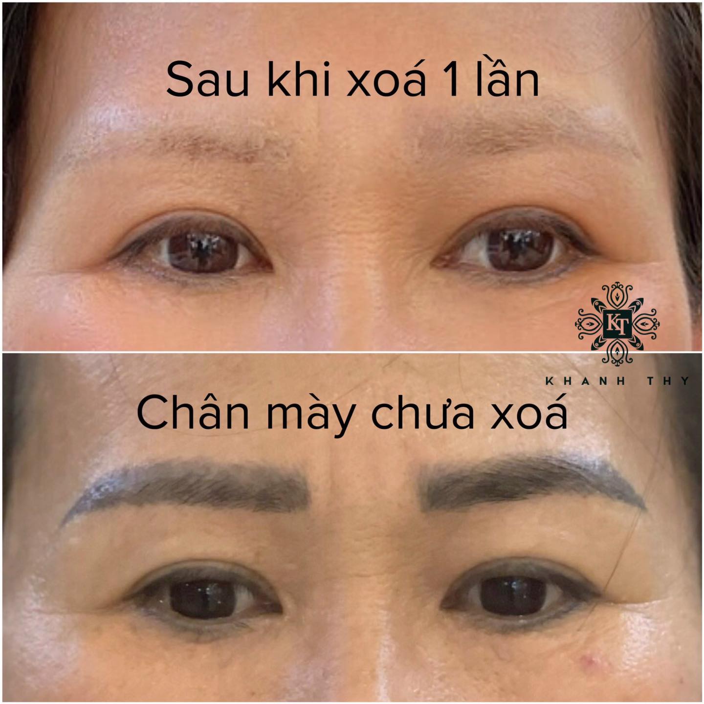 Thẩm Mỹ Viện Khánh Thy ảnh 1