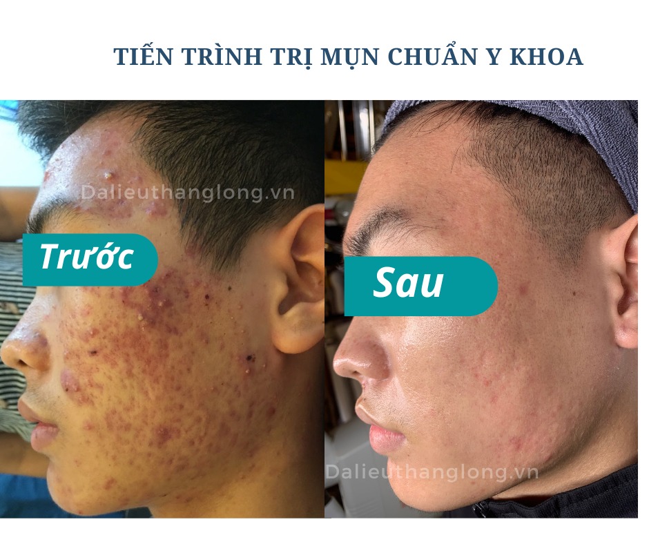 Thăng Long Beauty Clinic - Chi nhánh Ninh Bình ảnh 1