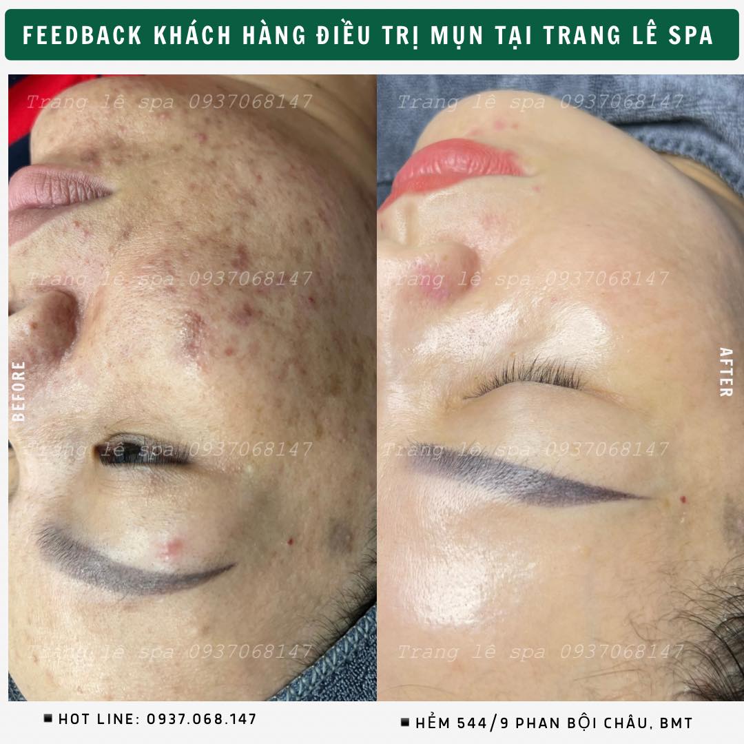 Trang Lê Spa ảnh 2