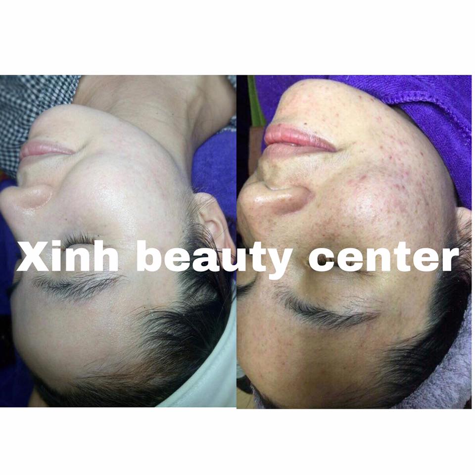 Xinh Beauty Center ảnh 2