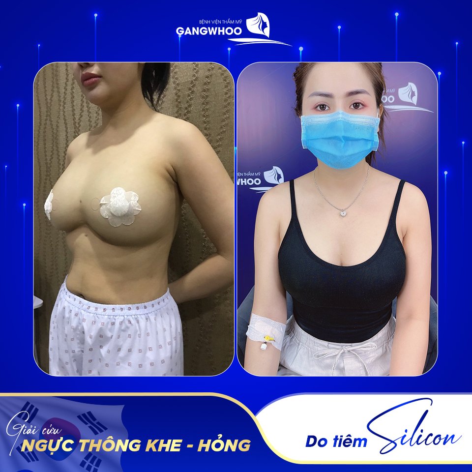 Bệnh Viện Thẩm Mỹ Gangwhoo ảnh 1