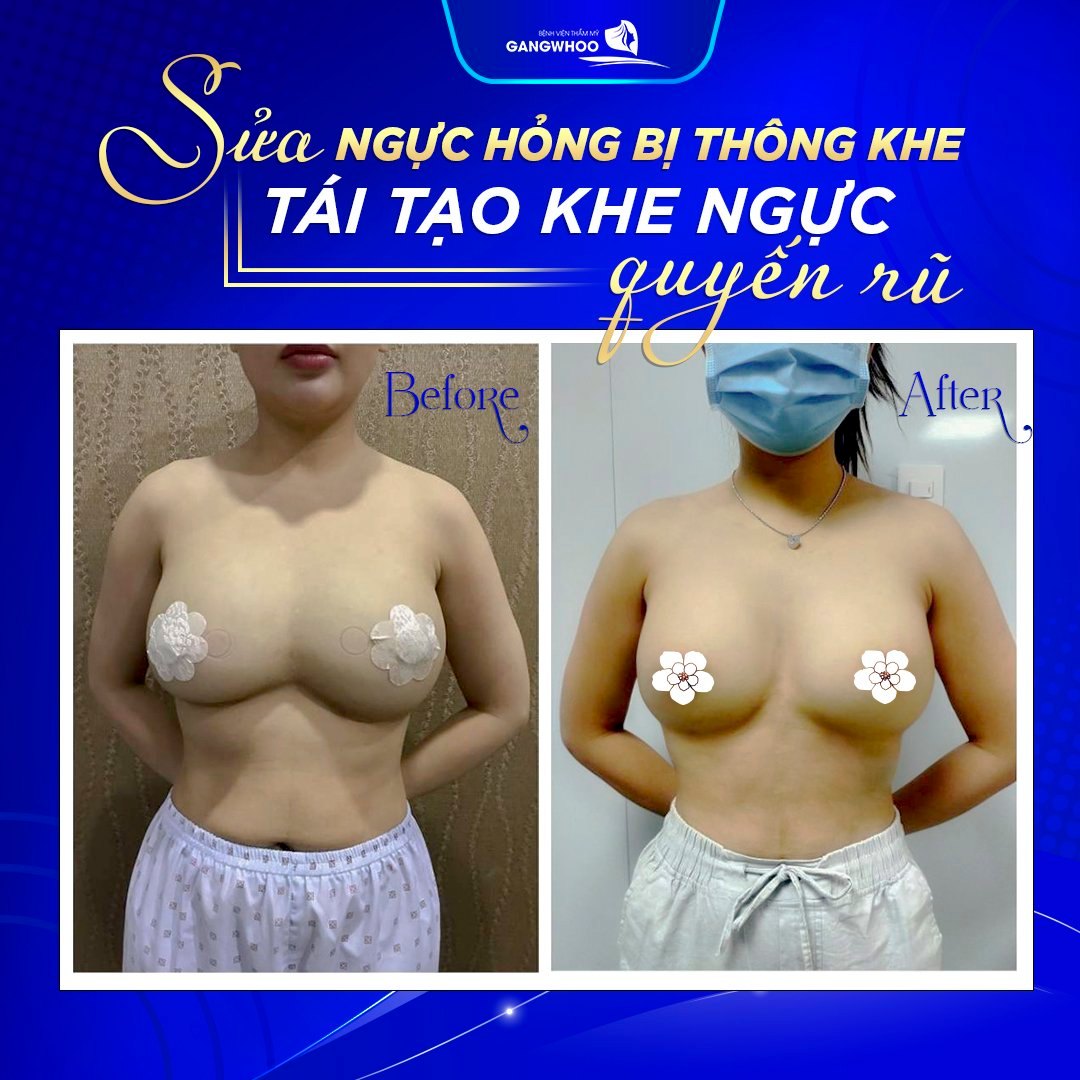 Bệnh Viện Thẩm Mỹ Gangwhoo ảnh 2