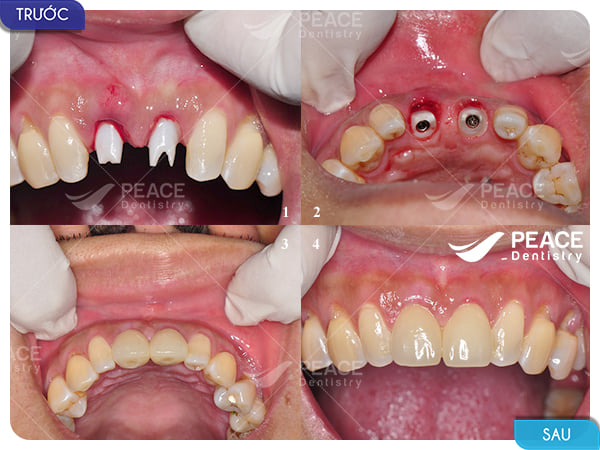 Nha khoa Peace Dentistry ảnh 1