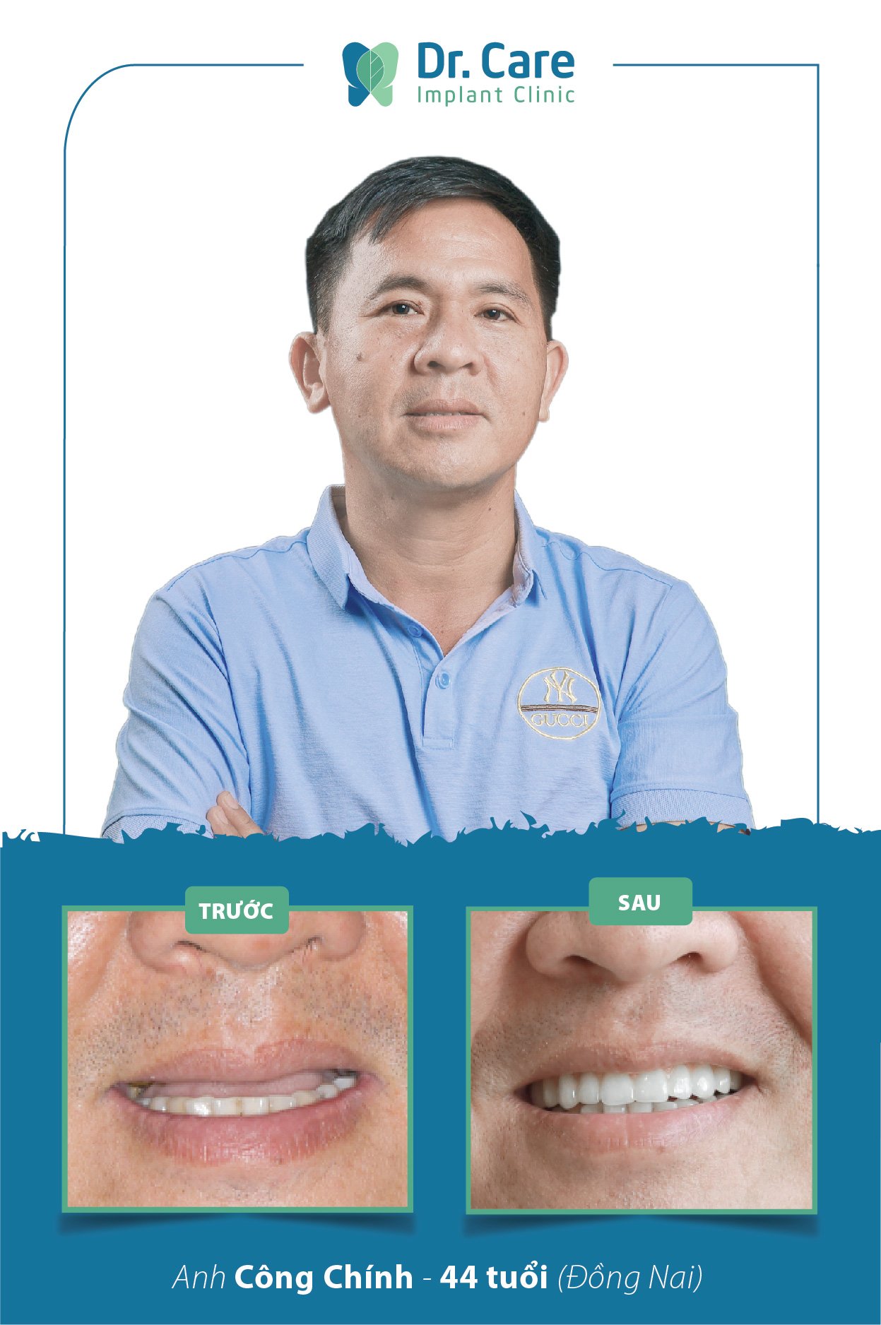 Dr. Care - Liệu Pháp Trồng Răng Không Đau ảnh 2