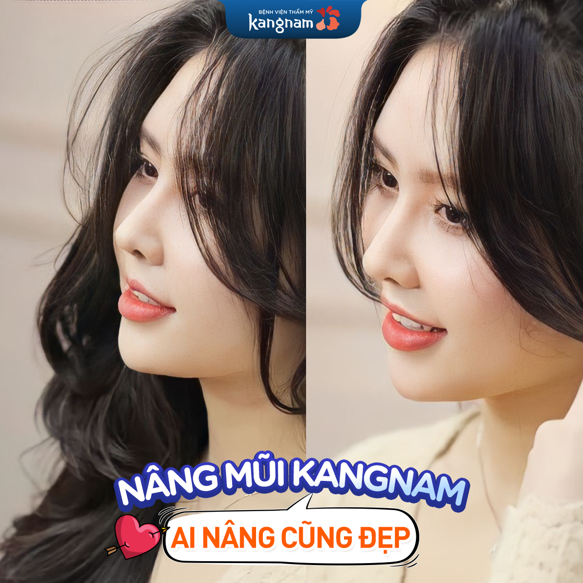 Nâng mũi - BVTM Kangnam ảnh 2