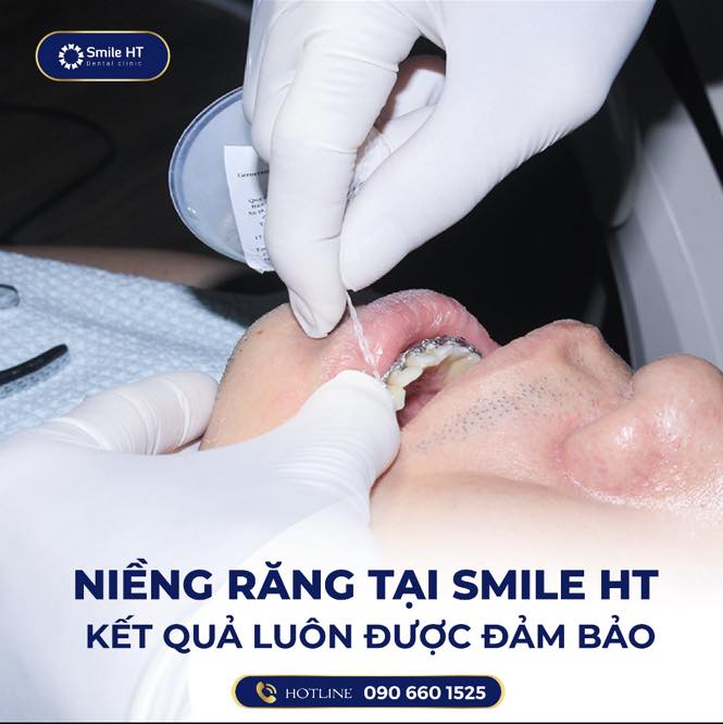 Nha Khoa Thẩm Mỹ Smile HT ảnh 2