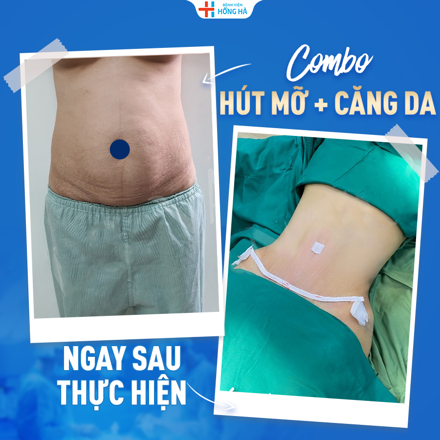 Thẩm Mỹ Bệnh Viện Hồng Hà ảnh 1