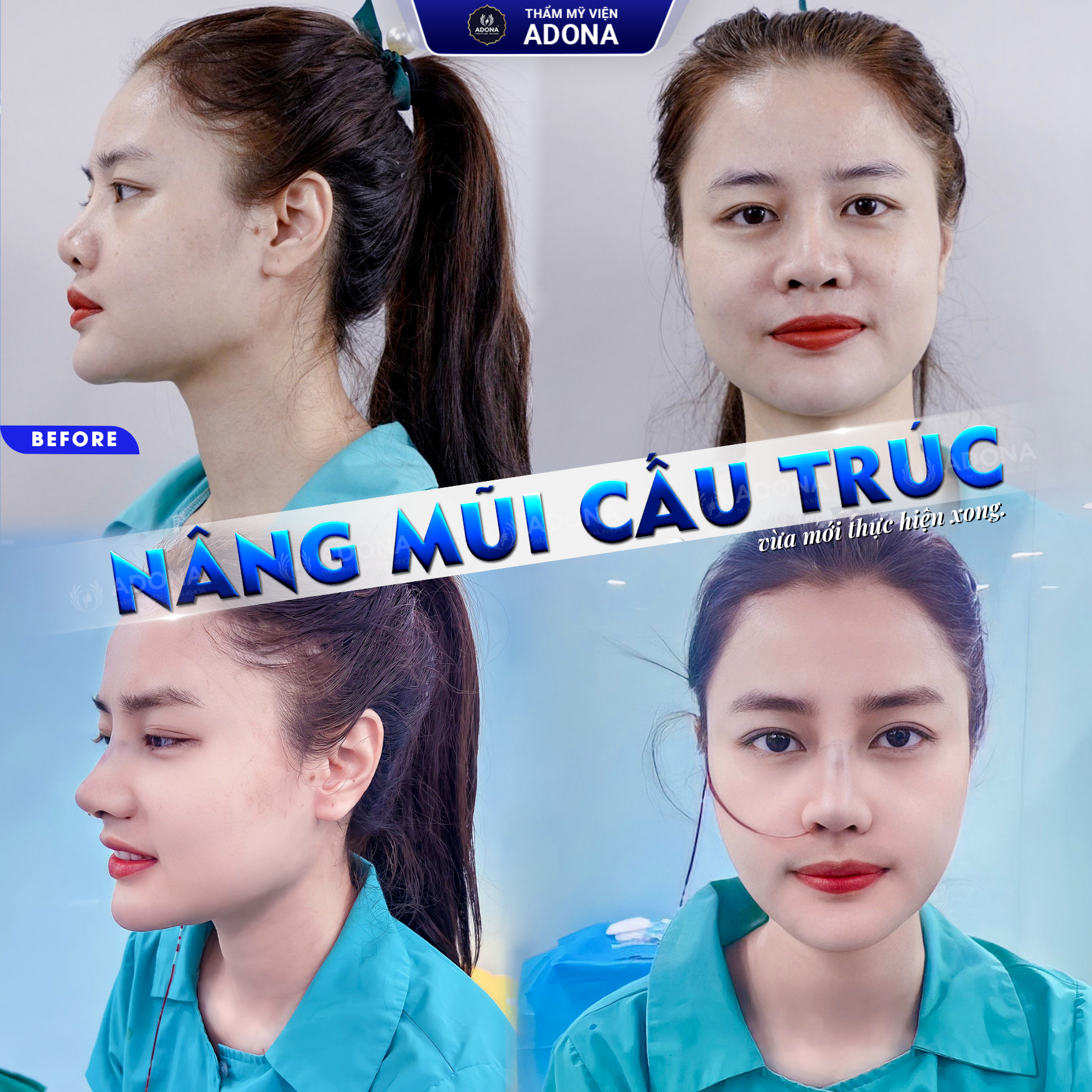 Thẩm Mỹ Viện ADONA ảnh 1