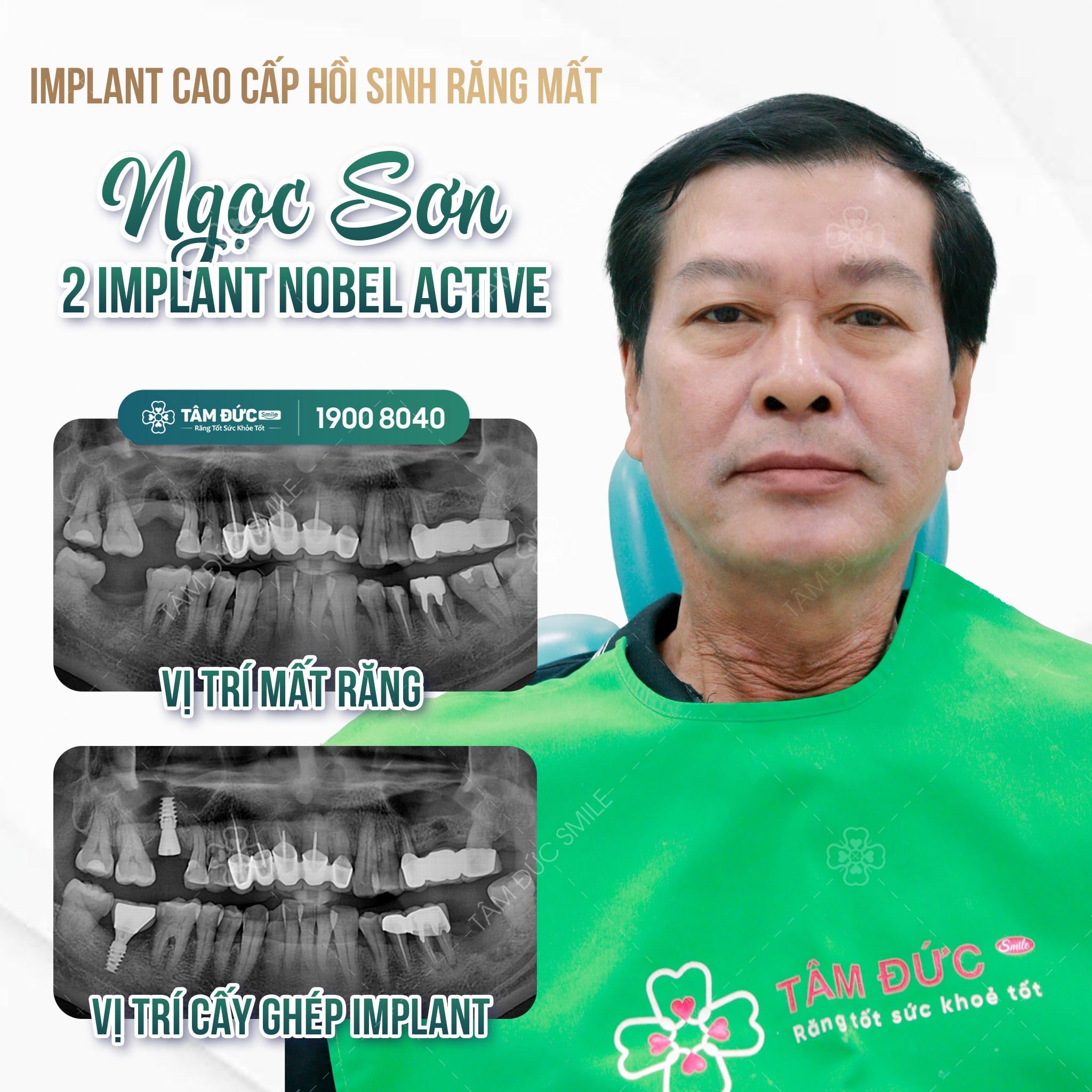 Viện Cấy Ghép Implant TÂM ĐỨC SMILE ảnh 1