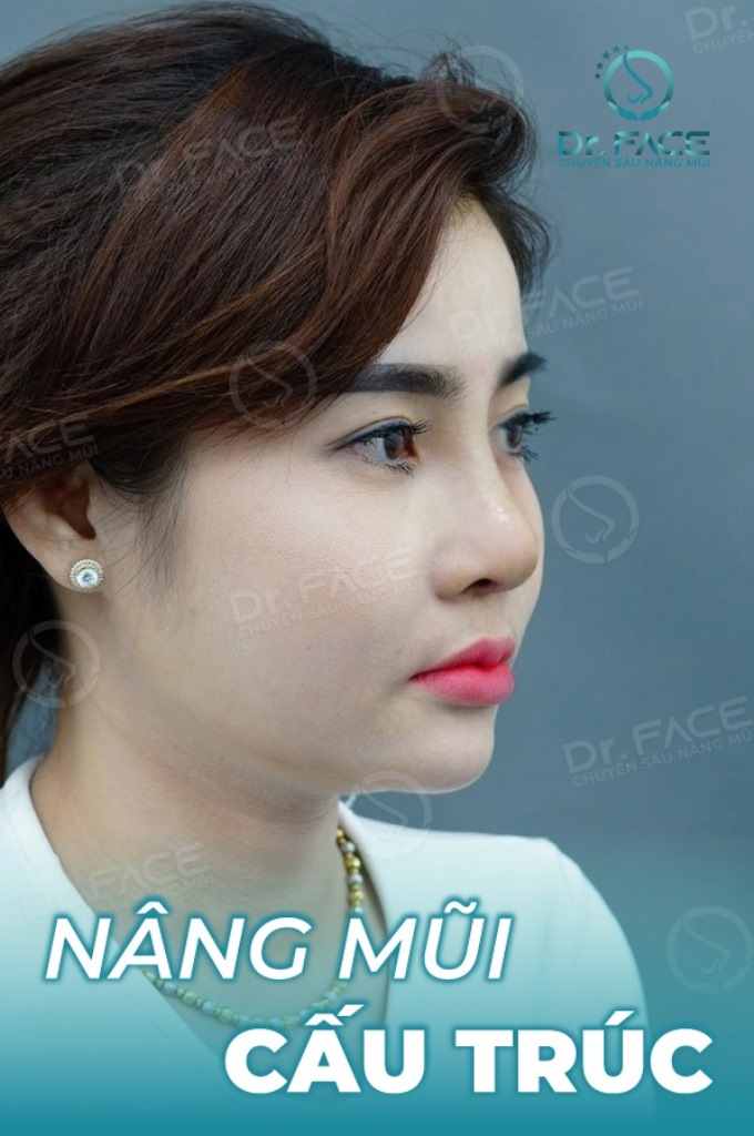 Viện Nâng Mũi Bác Sĩ Trần Phương ảnh 2