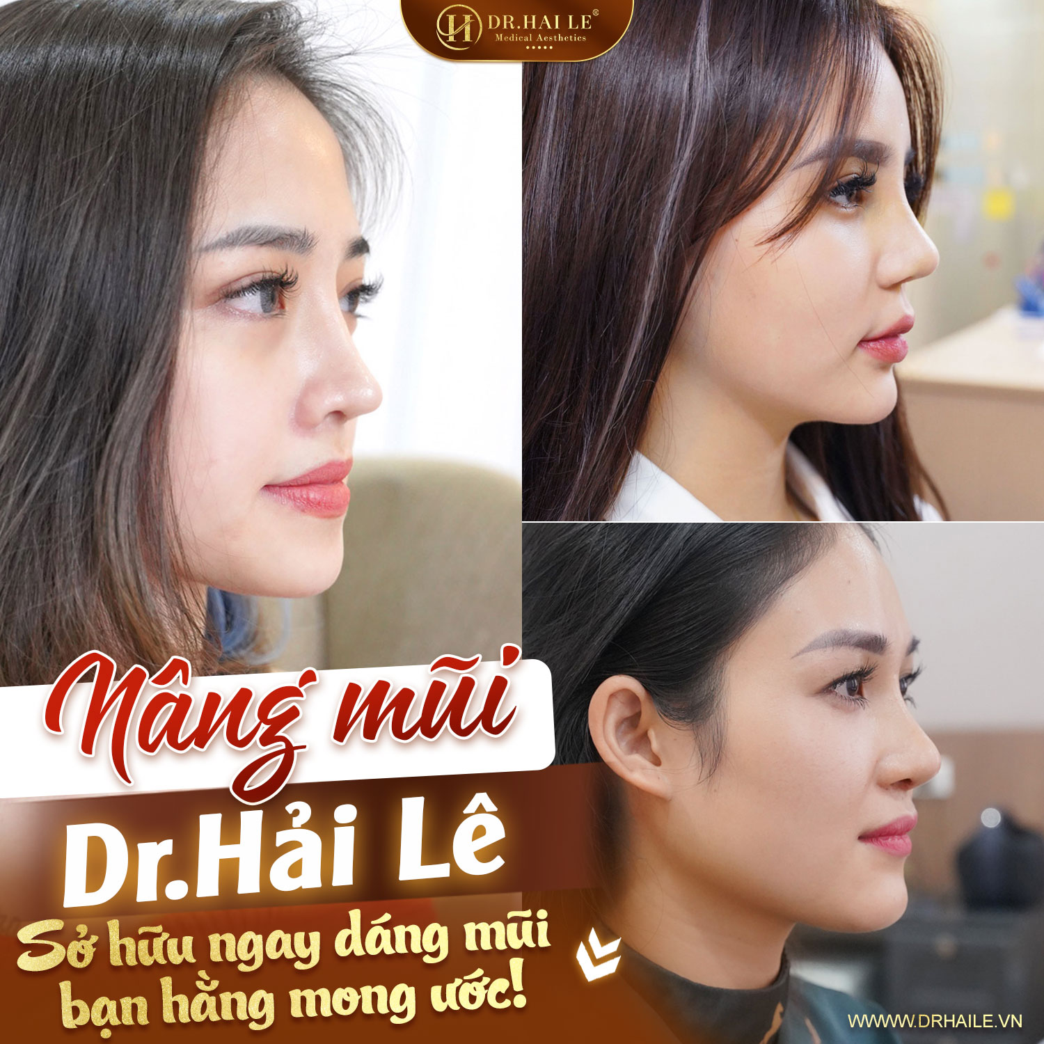 Viện Thẩm Mỹ Y Khoa Dr.Hải Lê ảnh 2