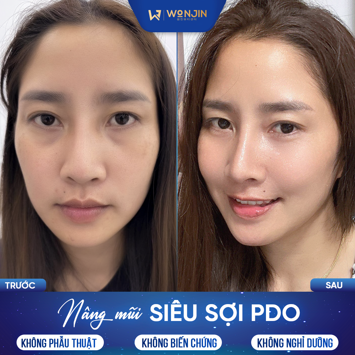 Viện thẩm mỹ Wonjin Việt Nam ảnh 2