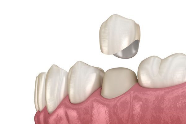 địa chỉ bọc răng sứ thẩm mỹ uy tín nhất quận 1, Tp HCM
