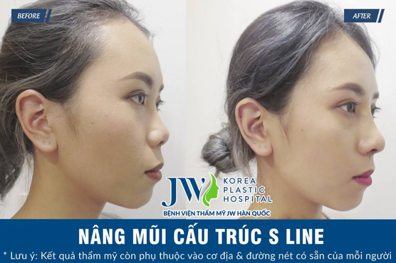 Bệnh viện phẫu thuật thẩm mỹ JW Hàn Quốc ảnh 2