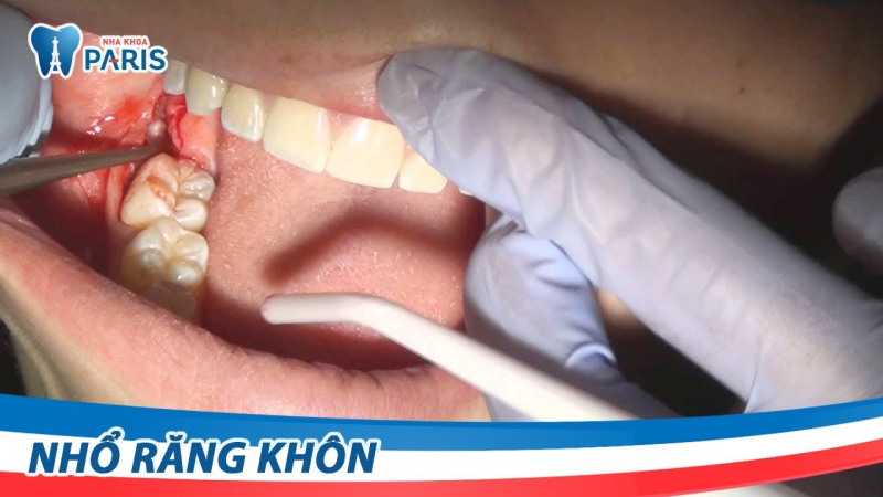 Nha khoa Paris ảnh 1