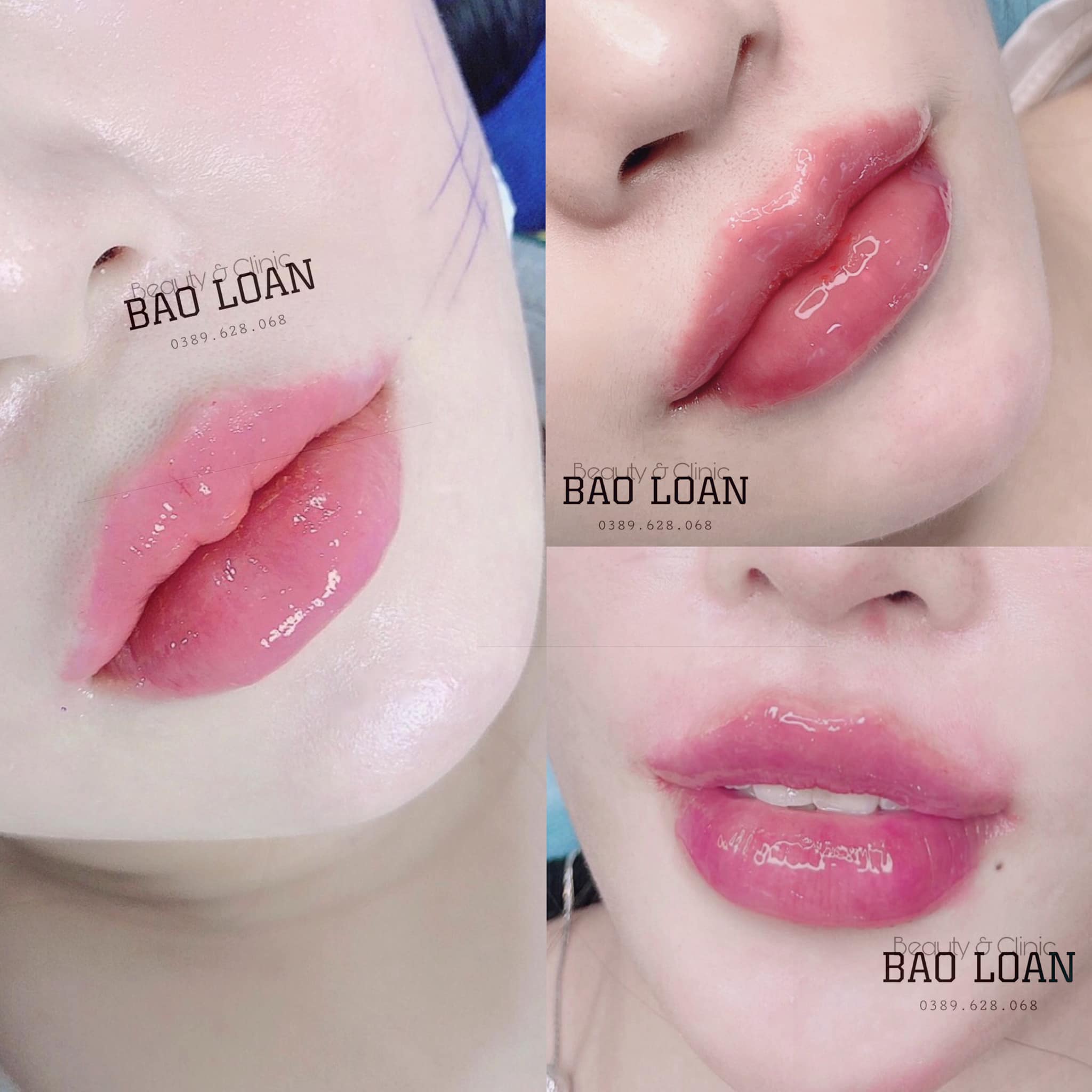 Bảo Loan Beauty ảnh 2