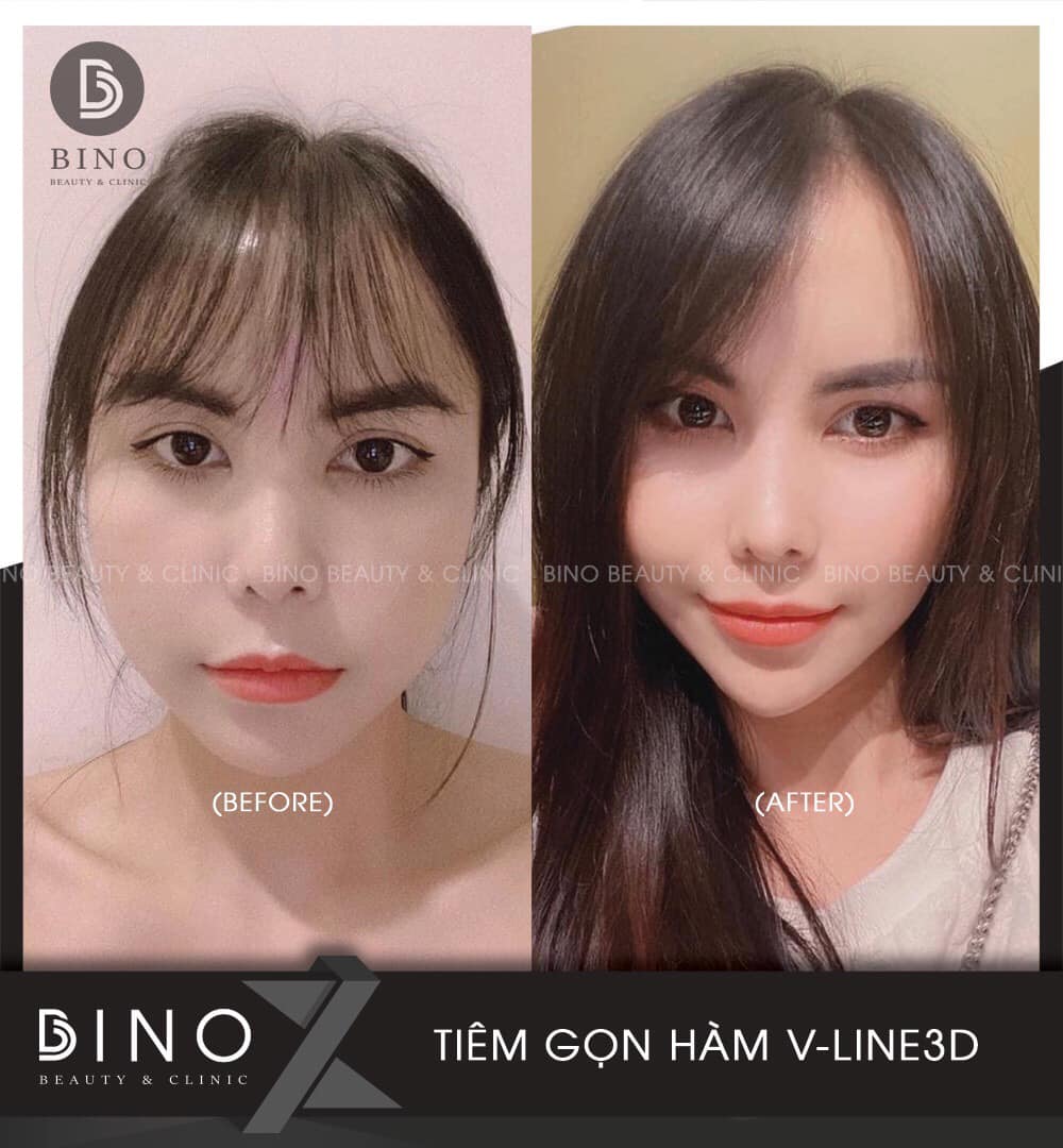 Bino Beauty & Clinic ảnh 1