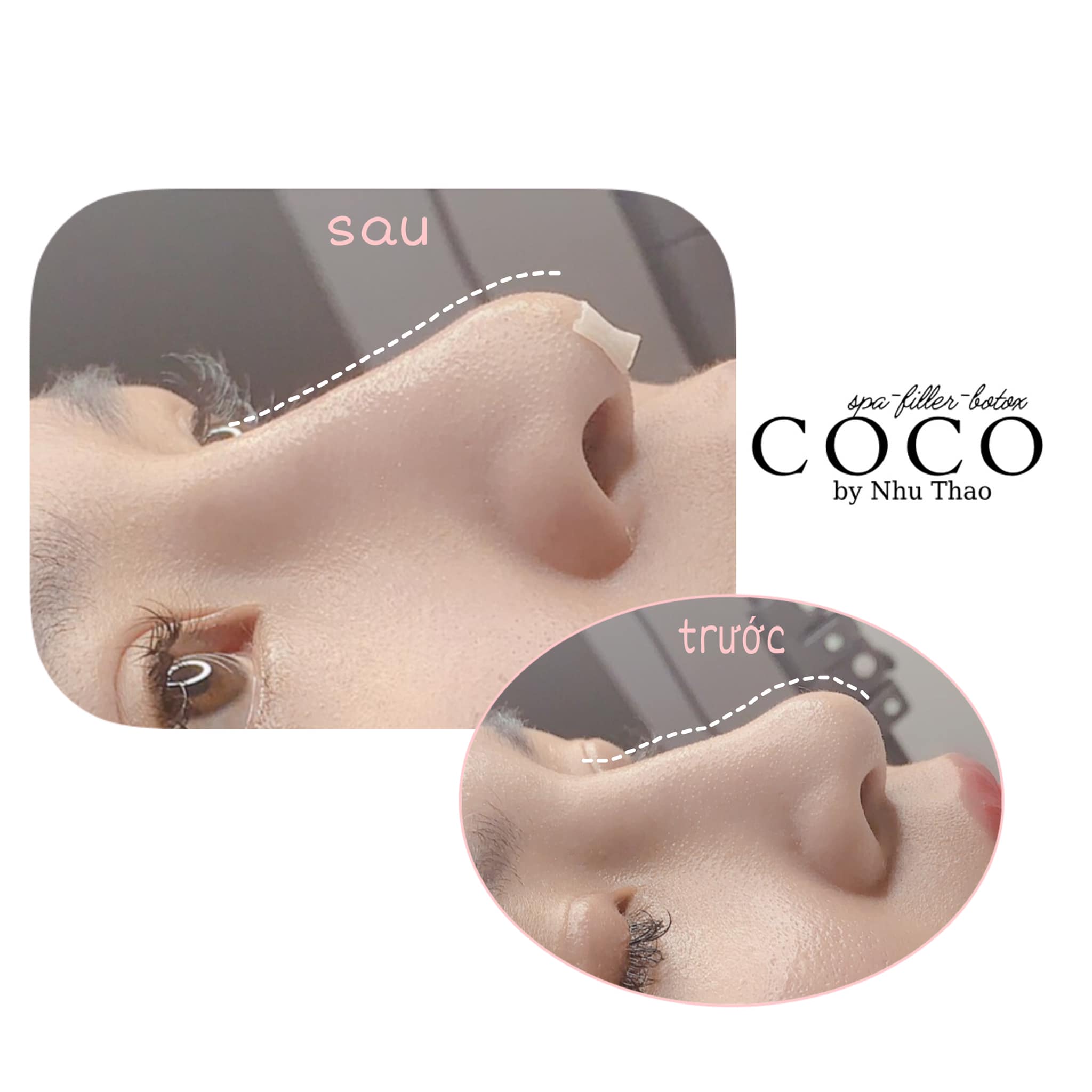 COCO Beauty Spa & Clinic ảnh 2