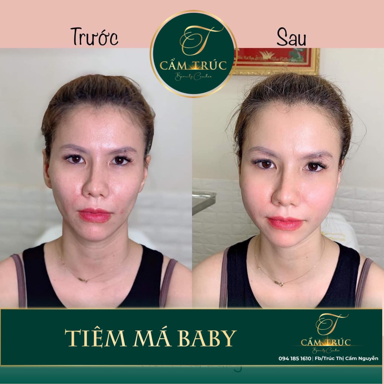 Cẩm Trúc Beauty Center ảnh 1