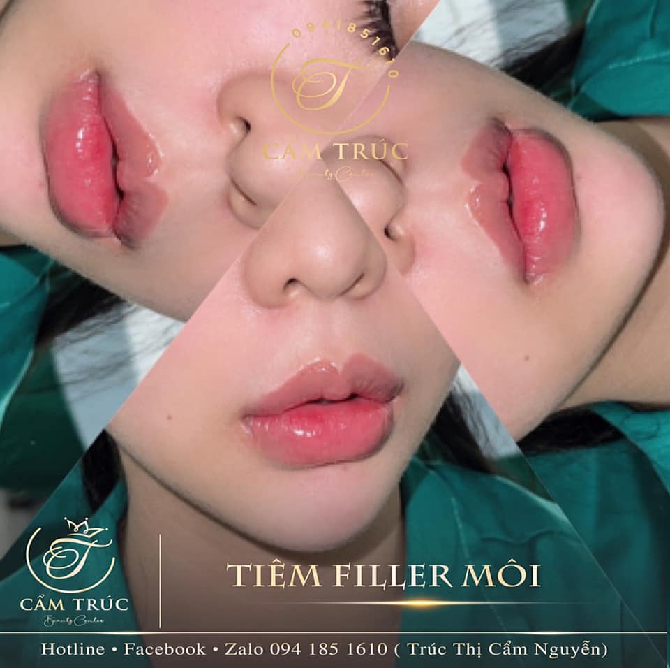 Cẩm Trúc Beauty Center ảnh 2